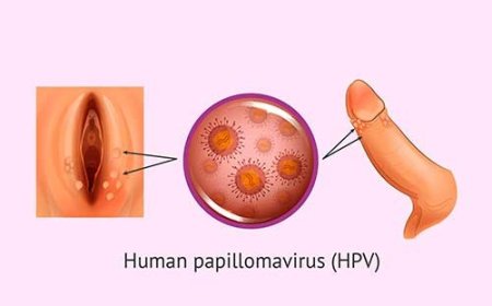 What Are Genital Warts?
