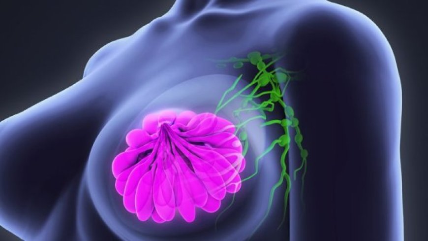 Breast Cancer in Nigeria