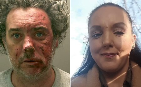 Man Sentenced to Life for Murdering Partner with Fire Attack