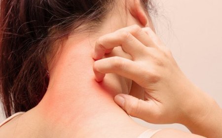 Itching After Bathing: How to Prevent It