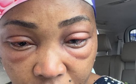 " I had severe eye infection, was hospitalised during filming of ‘Thin Line’  "-Mercy Aigbe