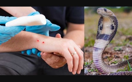 Snake Bite First Aid: Stay Calm and Act Wisely
