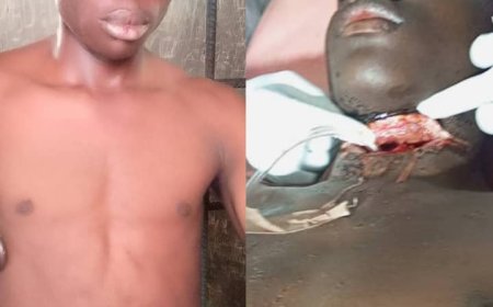 Attempted Murder in Kogi State: Man Arrested for Attacking Friend