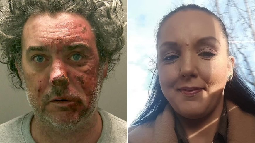 Man Sentenced to Life for Murdering Partner with Fire Attack