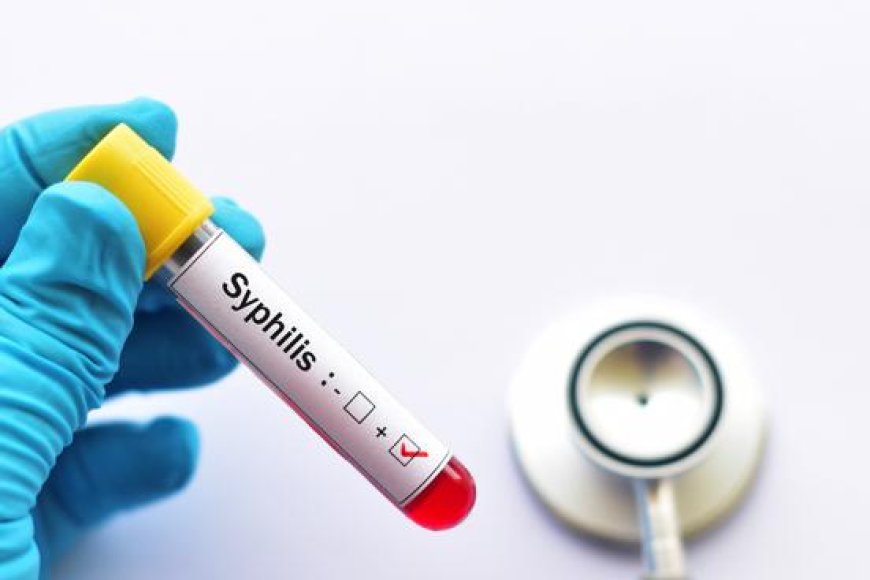 The Rise of Syphilis Cases Worldwide