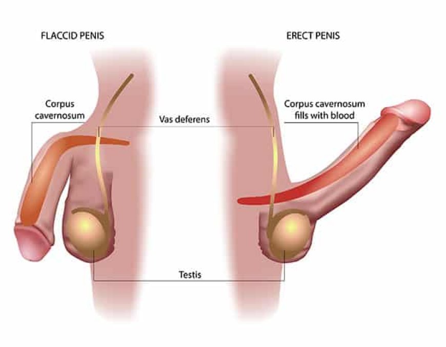 Erectile dysfunction (ED) can be influenced by various factors