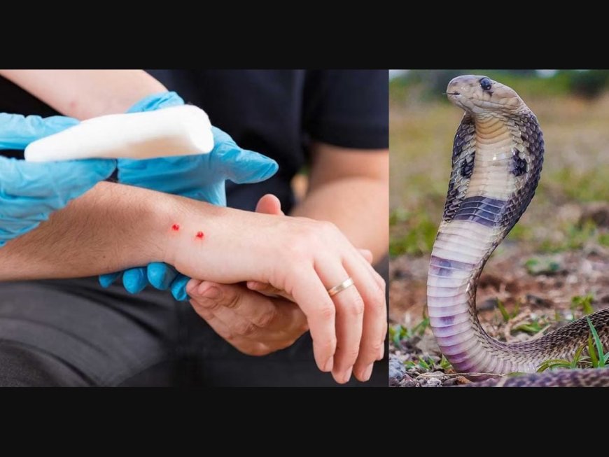 Snake Bite First Aid: Stay Calm and Act Wisely