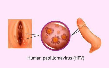 Genital warts, caused by certain strains of the human papillomavirus (HPV), can indeed be a significant public health concern.