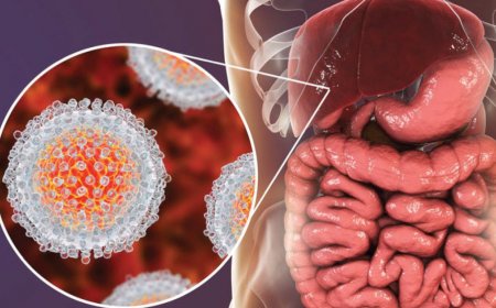 Hepatitis B ----- A Sexually Transmitted Disease