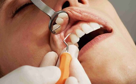 Deep Dental Cleaning