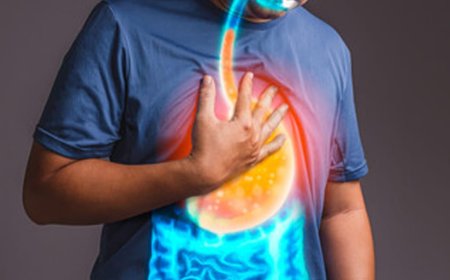 *Understanding Heartburn
