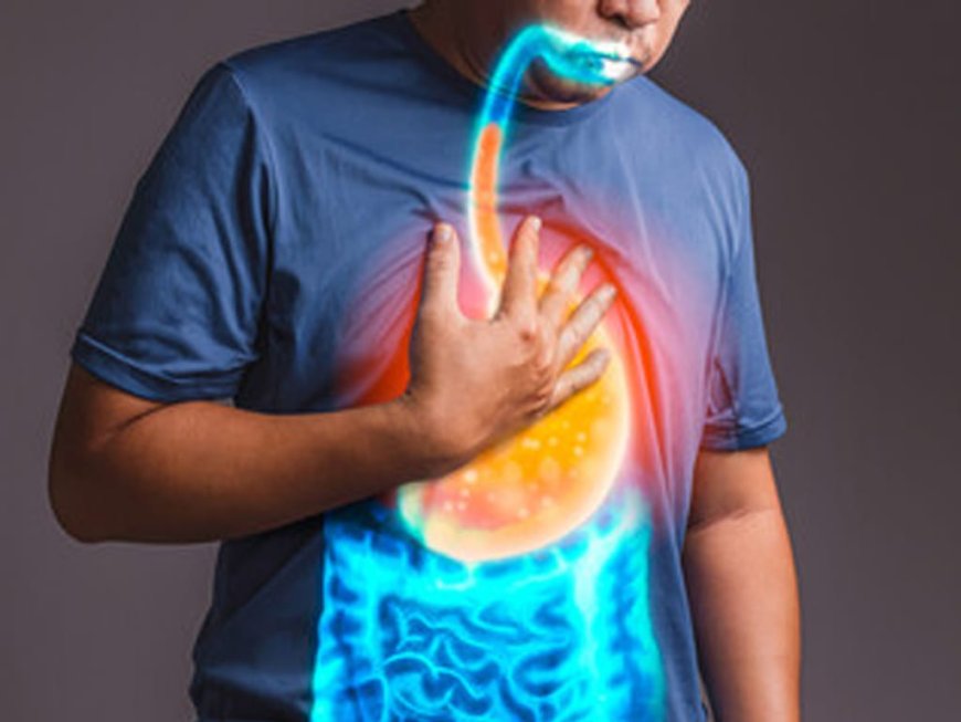 *Understanding Heartburn