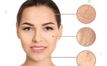 *Skin Types and Their Care
