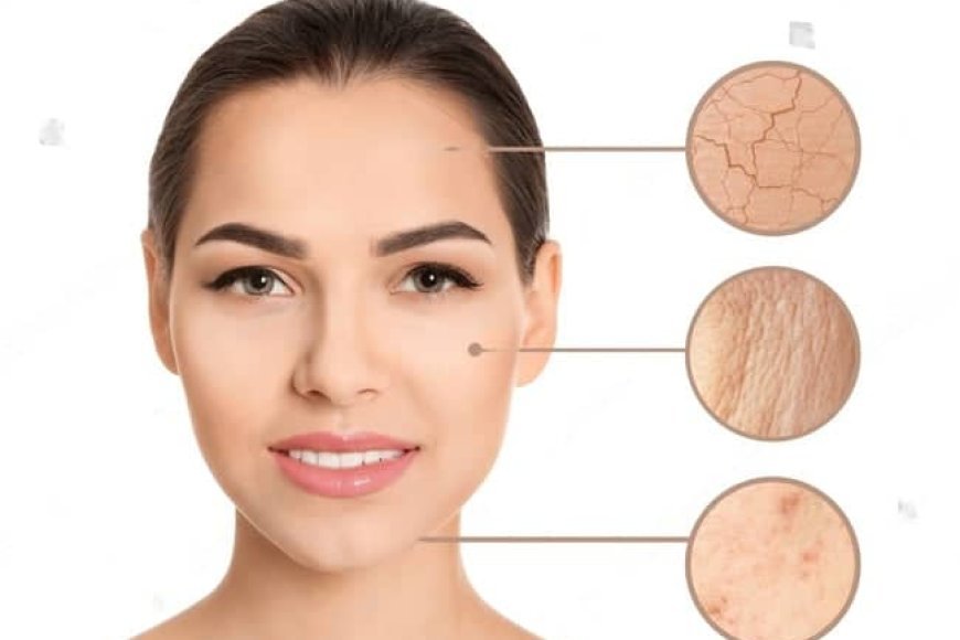 High Risk Skin Types *Skin Types and Their Care - As E Dey Happen