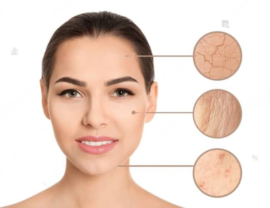 *Skin Types and Their Care