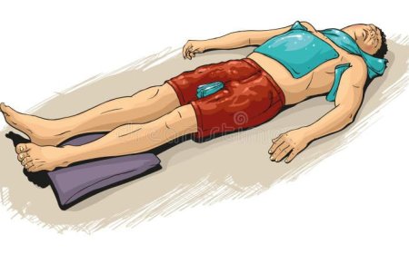 *Sun Stroke Symptoms