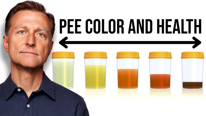 *What Your Urine Says About Your Health ------ Don’t Ignore Frequent Urination or Color Changes