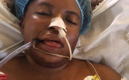 Unidentified Woman Found Unconscious in Abuja, National Hospital Seeks Public Help
