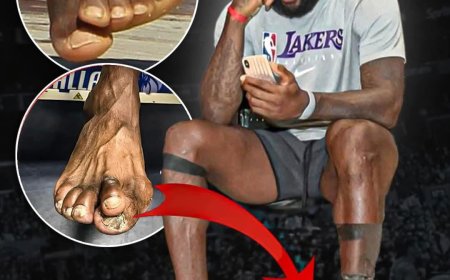 The state of LeBron James' feet after 23 years in the NBA