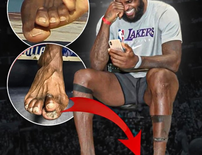 The state of LeBron James' feet after 23 years in the NBA