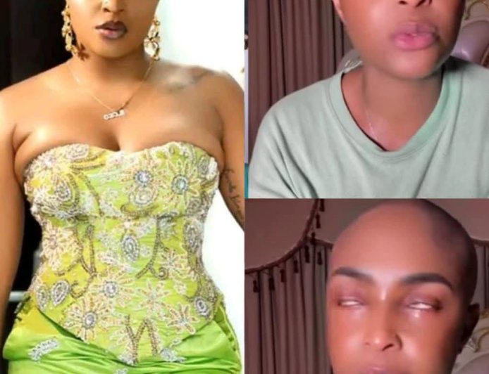 “My name is Nkiru Blessing, popularly known as Blessing CEO. I have been diagnosed with breast cancer, and I urgently need surgery.