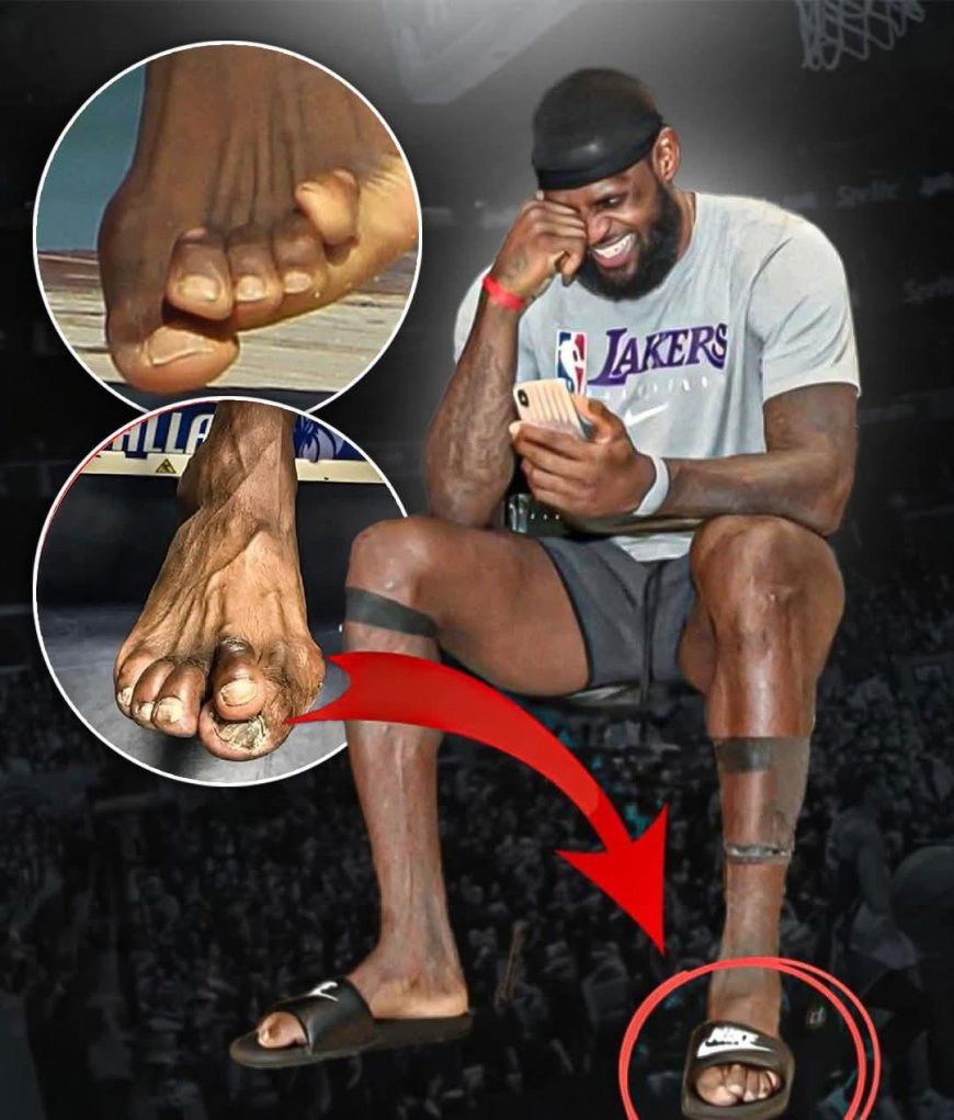 The state of LeBron James' feet after 23 years in the NBA