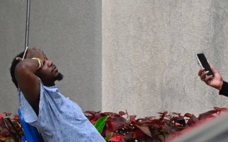 photos of Offset after he was shot outside a casino.   He’s in a wheelchair having a smoke outside the hospital where he’s receiving treatment