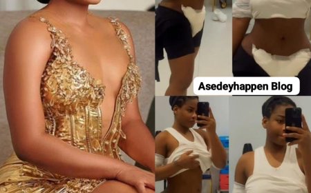 BBNaija star Phyna shares her new look three days post-BBL surgery.