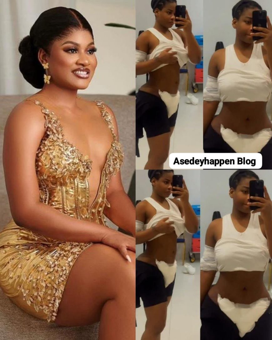 BBNaija star Phyna shares her new look three days post-BBL surgery.