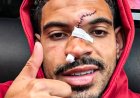Morgan Gibbs-White shared an update on Instagram after his nasty clash of heads against Chelsea