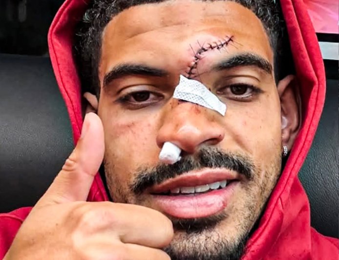 Morgan Gibbs-White shared an update on Instagram after his nasty clash of heads against Chelsea