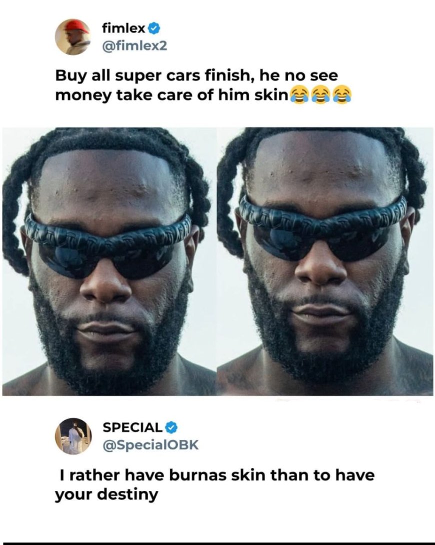 Man claims Burna Boy bought all the supercars but couldn’t afford proper skincare