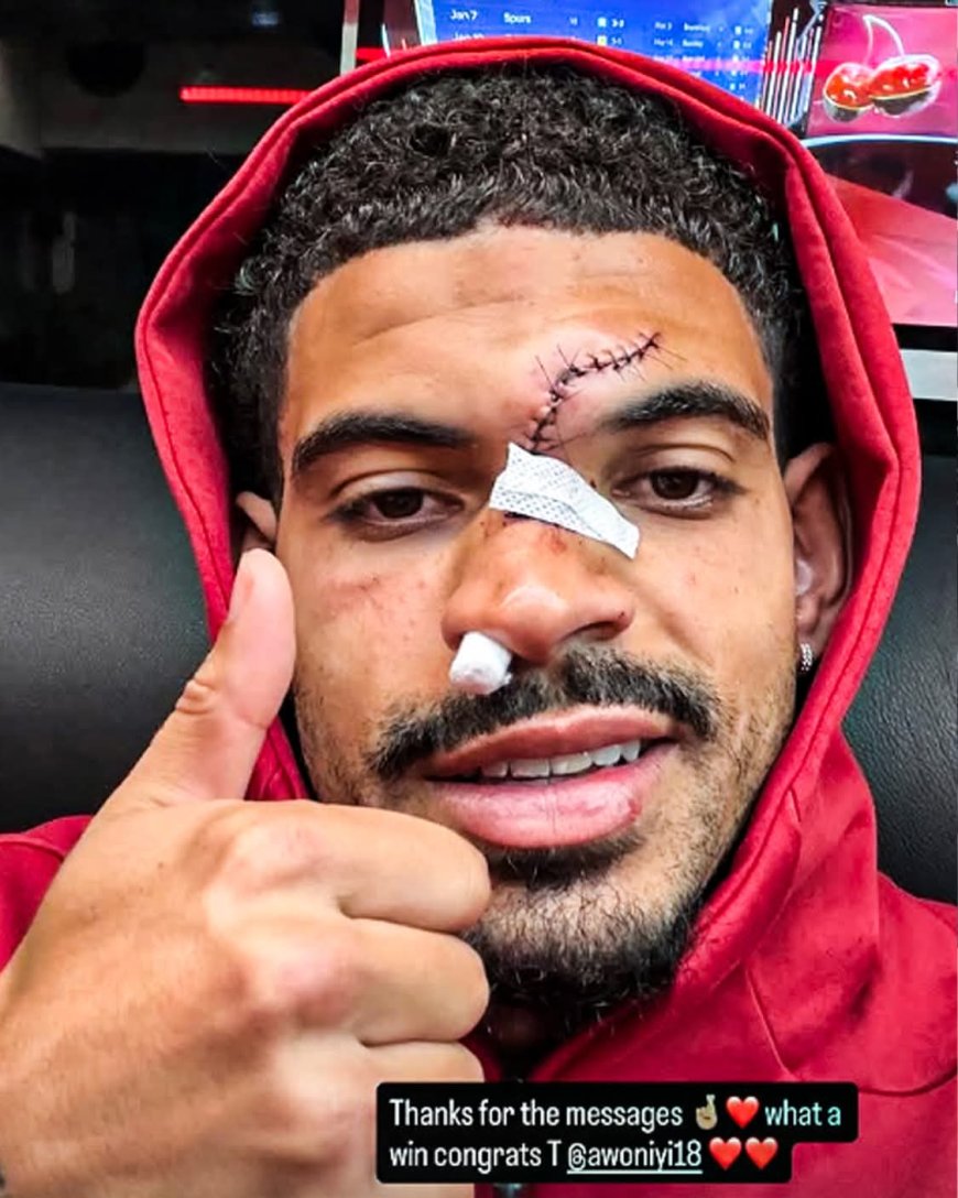 Morgan Gibbs-White shared an update on Instagram after his nasty clash of heads against Chelsea